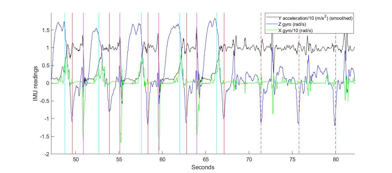 Graph of accelerometer data from a stroke